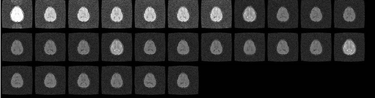 11.5. first artifact image of first replicates with different signal gain then the rest