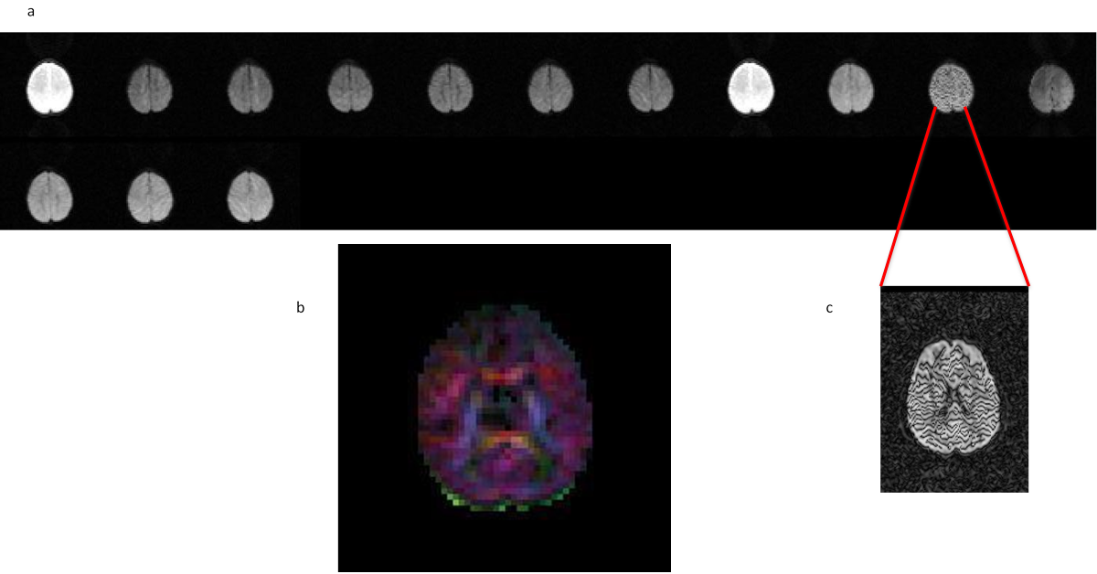 11.4. artifact image of Averaging at the scanner-a,b,c