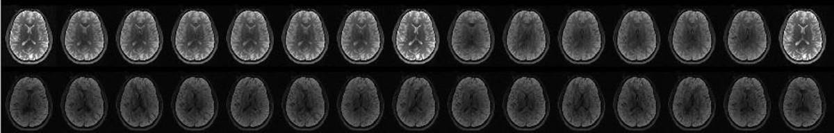 11.3 2. artifact image of Signal inhomogeneity