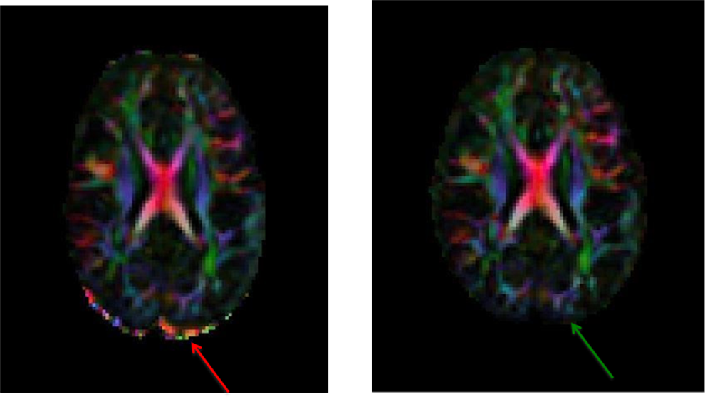 11.9. left and right image of DEC map output including and excluding the corrupt volume