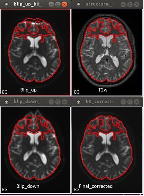 11.15. image of 2-way phase encoded DTI human data