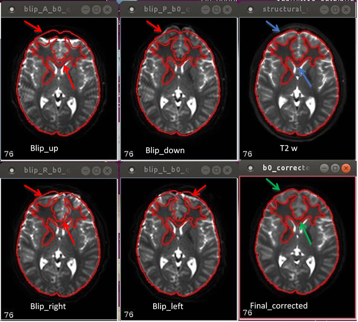 11.16. image of 4-way phase encoded DTI human data